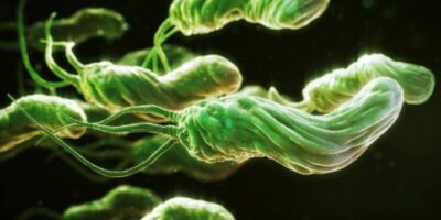 Миниатюра к статье Бактерия Helicobacter pylori может стать причиной вздутия живота