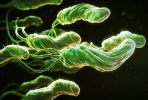 Миниатюра к статье Бактерия Helicobacter pylori может стать причиной вздутия живота