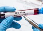 Миниатюра к статье Почему нет коллективного иммунитета от COVID-19