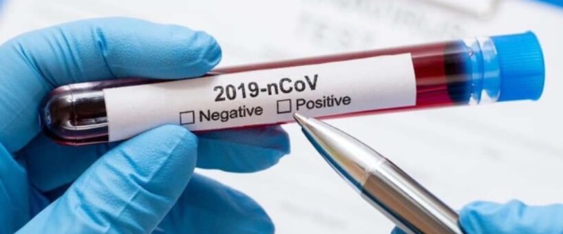 Миниатюра к статье Почему нет коллективного иммунитета от COVID-19