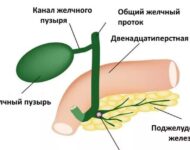 Миниатюра к статье Водянка желчного пузыря: причины, диагностика, лечение
