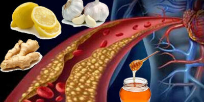 Миниатюра к статье Как быстро и эффективно снизить холестерин только продуктами