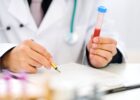 Миниатюра к статье Причины повышенной мочевой кислоты в крови и как снизить показатель