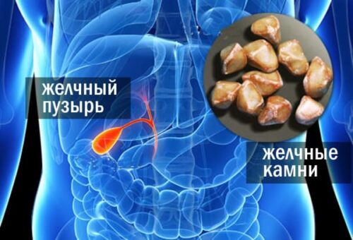 Миниатюра к статье Очищение желчного пузыря и разжижение желчи